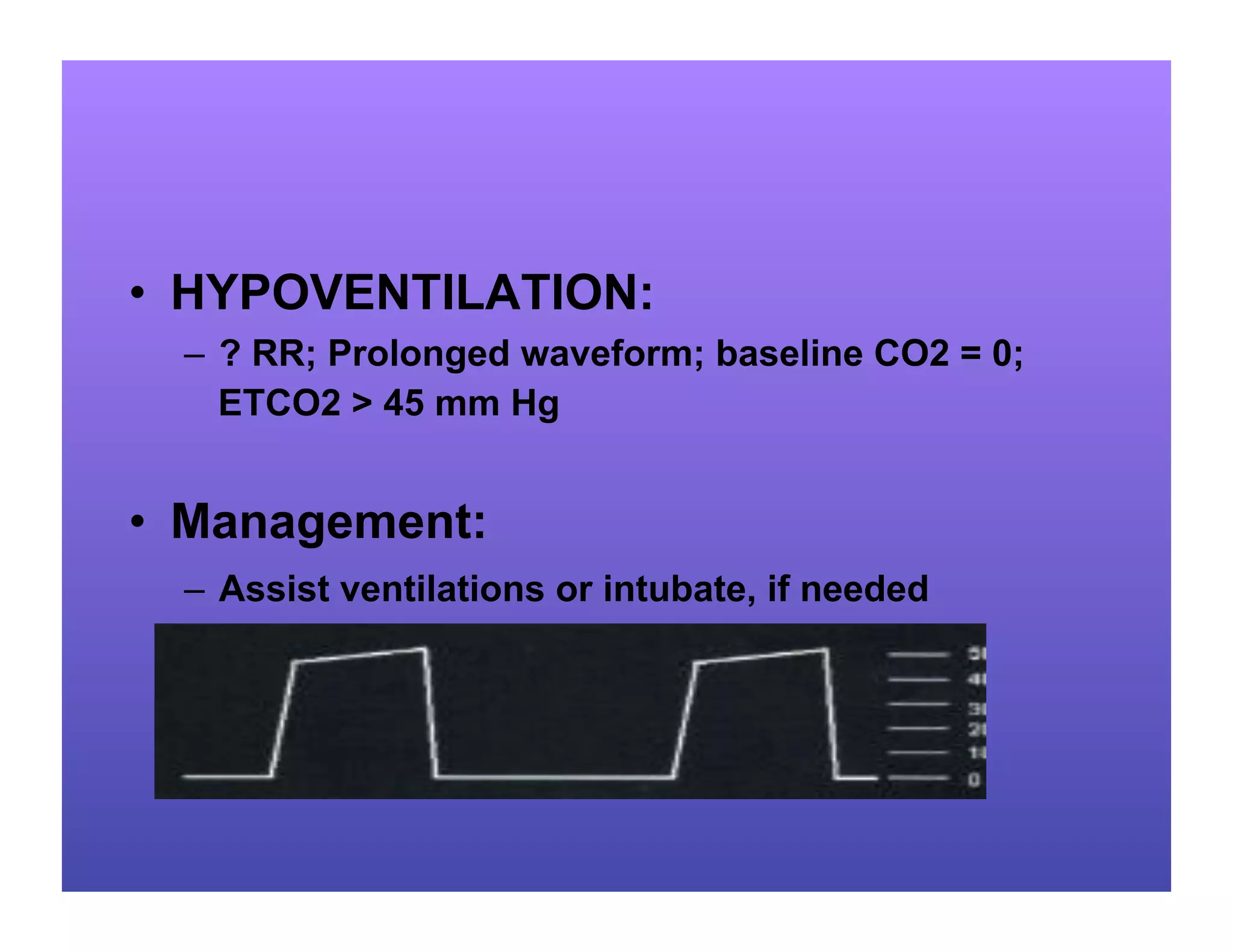 Capnography in ems.ppt