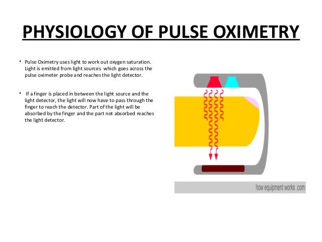 capnography vs plethysmography how a pulse oximeter works
