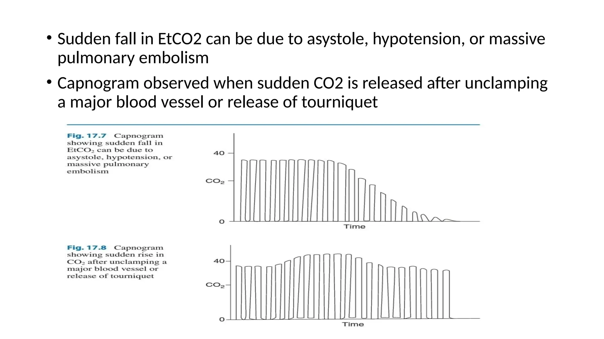 • Sudden fall in EtCO2 can be due to asystole, hypotension, or massive
pulmonary embolism
• Capnogram observed when sudden CO2 is released after unclamping
a major blood vessel or release of tourniquet
 