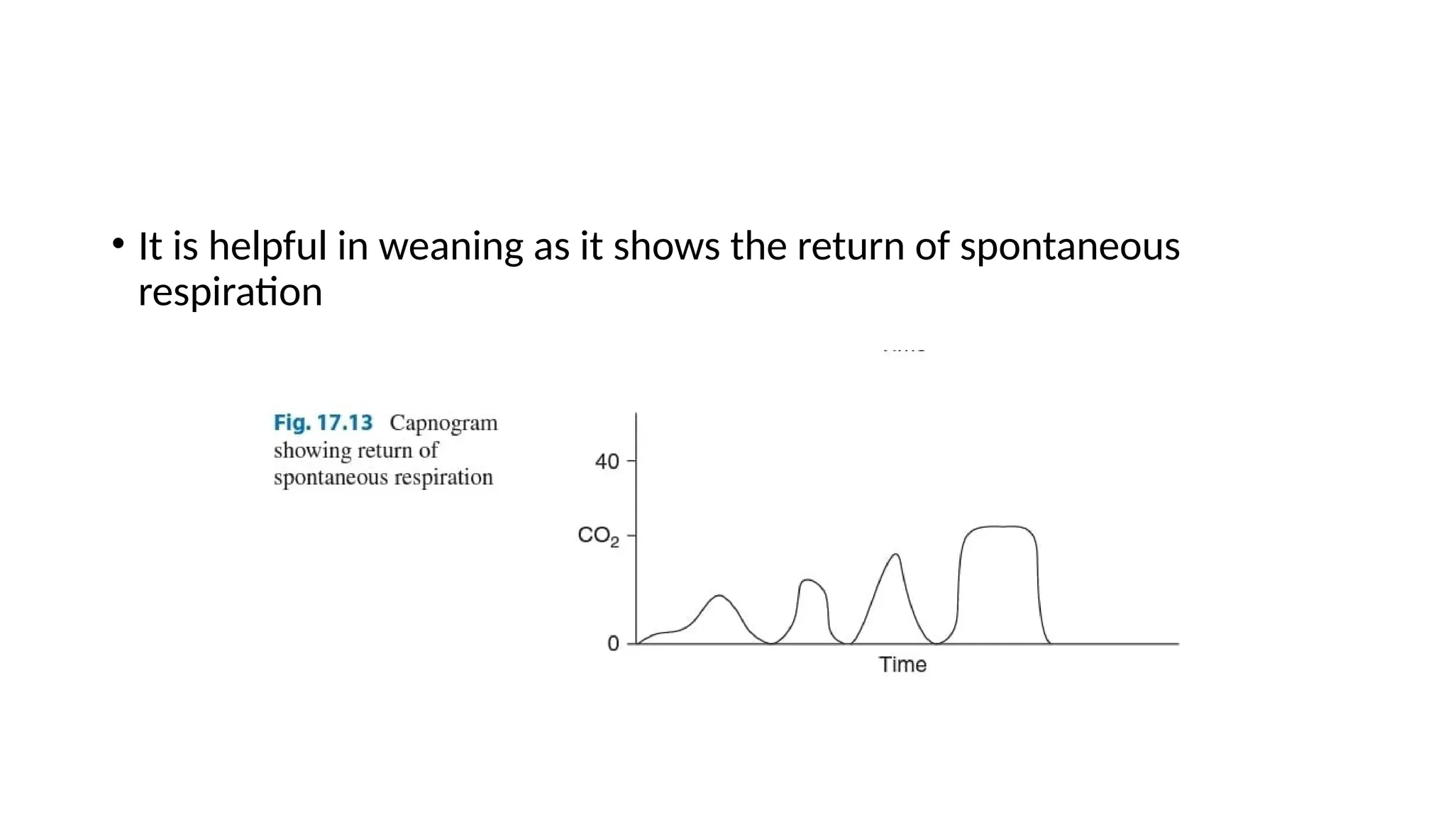 • It is helpful in weaning as it shows the return of spontaneous
respiration
 