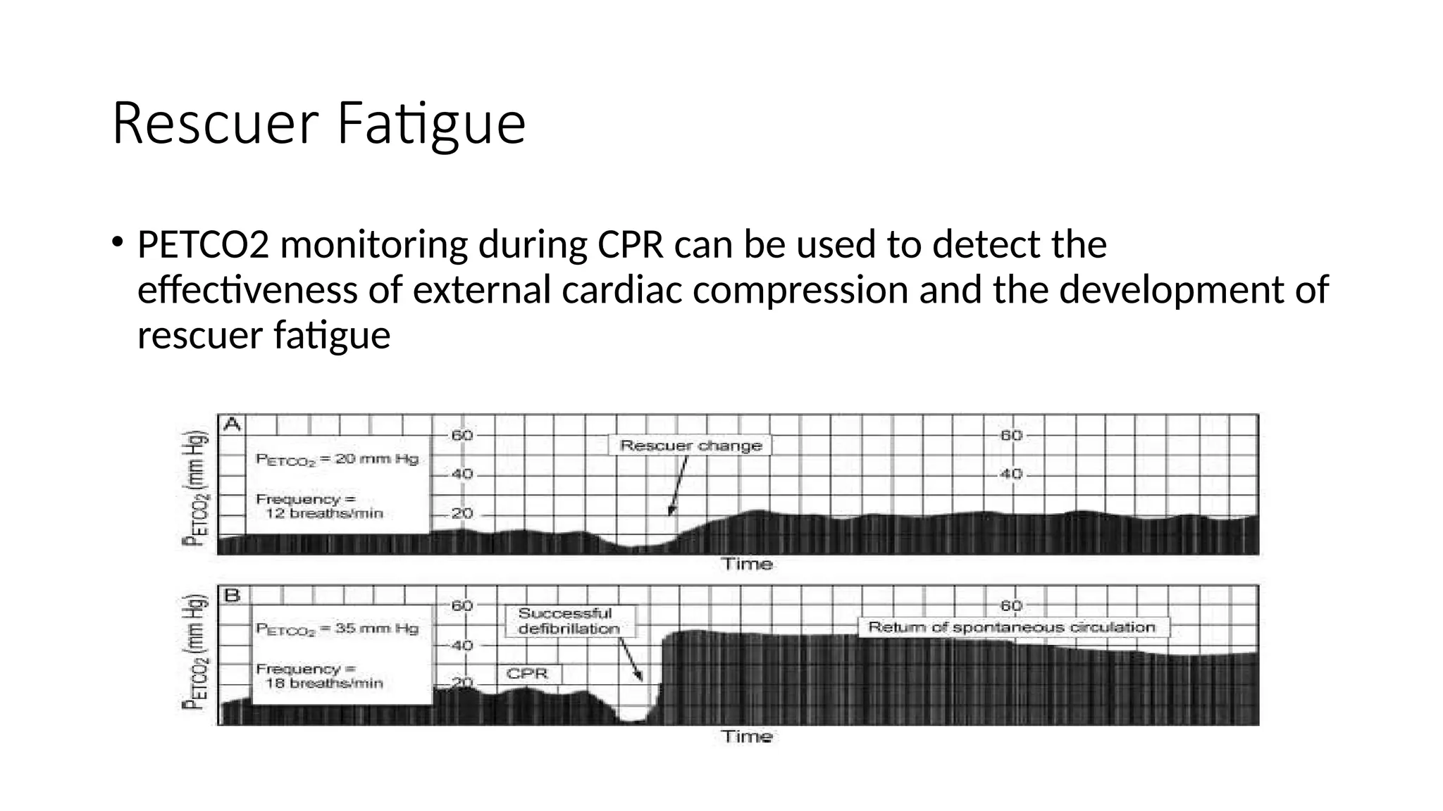 Rescuer Fatigue
• PETCO2 monitoring during CPR can be used to detect the
effectiveness of external cardiac compression and the development of
rescuer fatigue
 