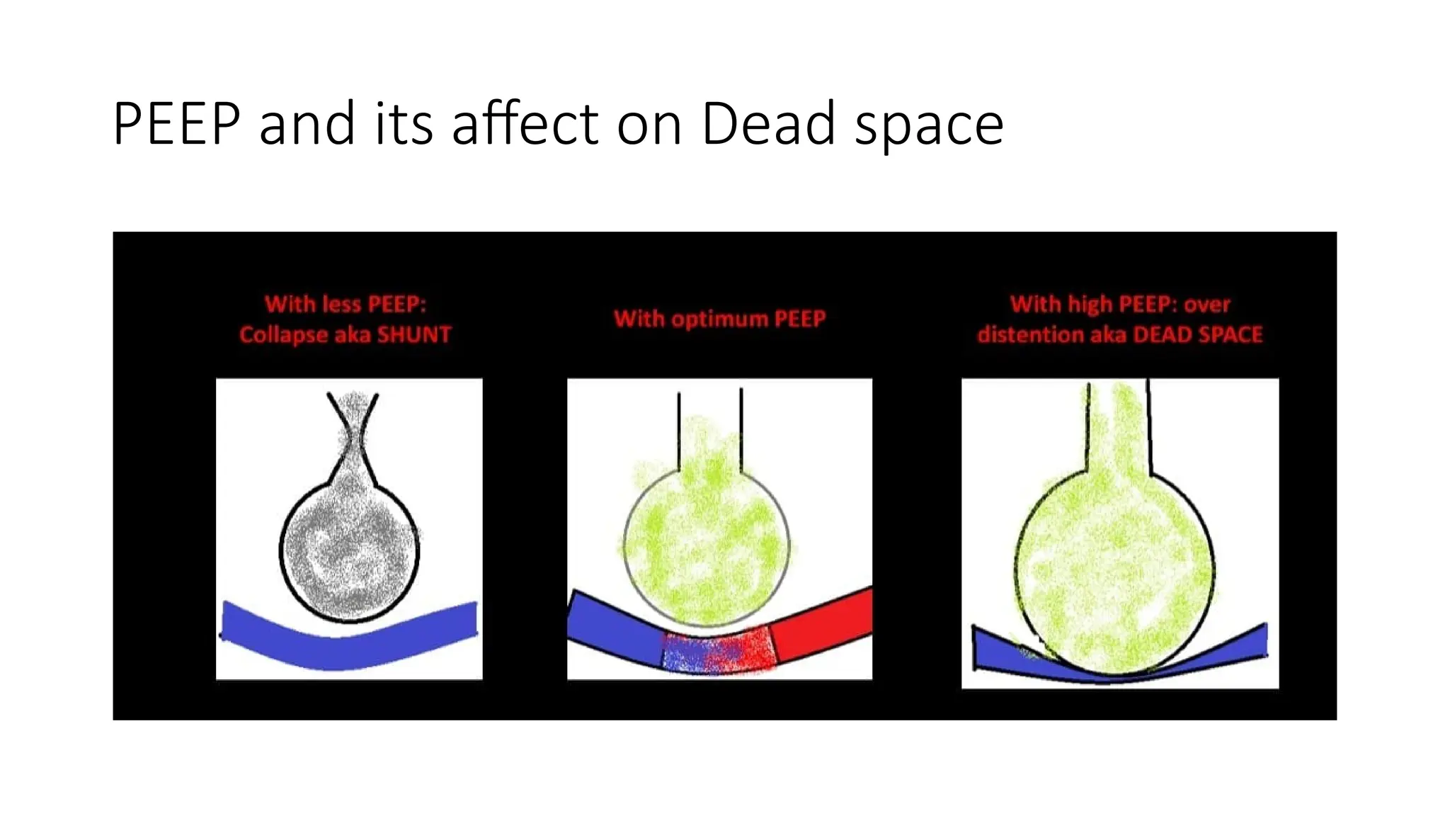 PEEP and its affect on Dead space
 