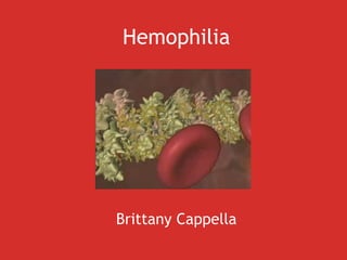 Hemophilia Brittany Cappella 