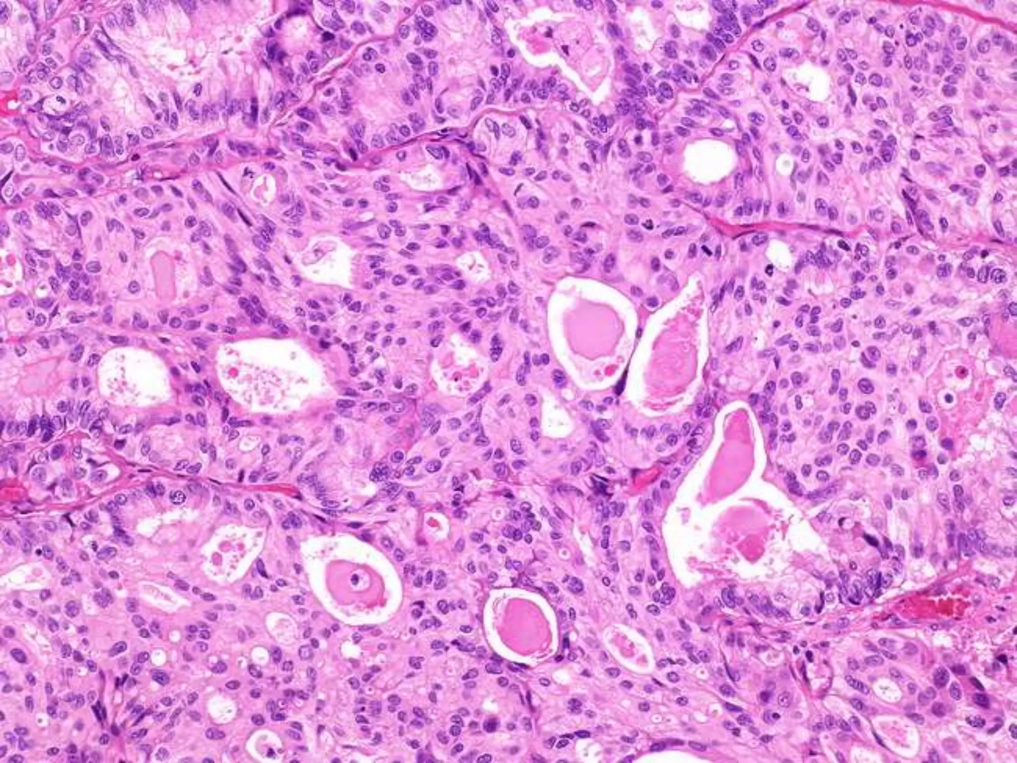 Cap protocol bladder | PPTX