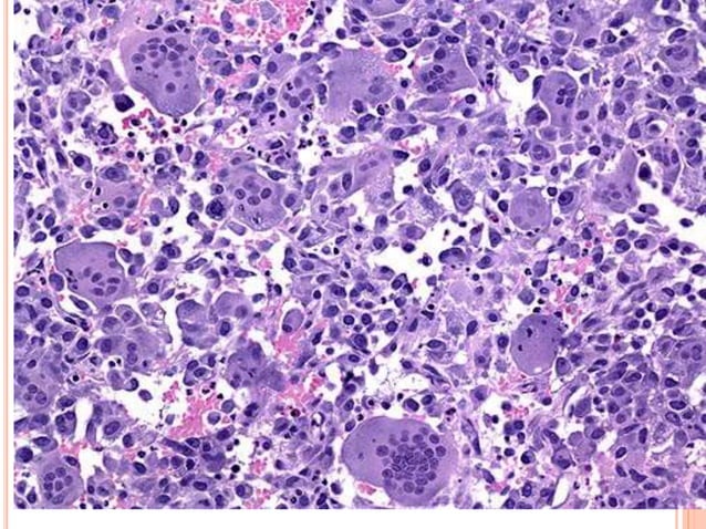 Cap protocol bladder | PPTX