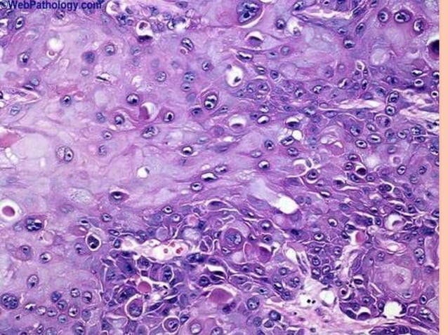 Cap protocol bladder | PPTX