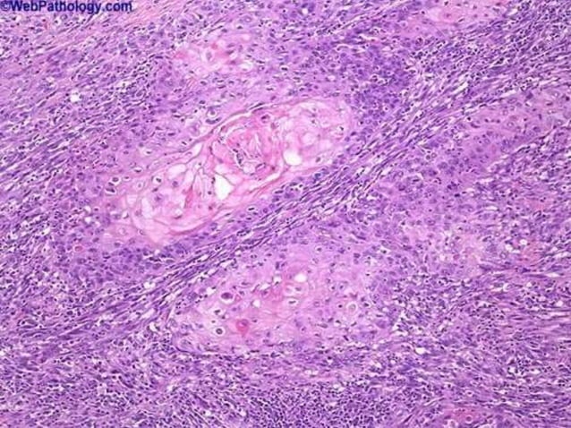 Cap protocol bladder | PPTX