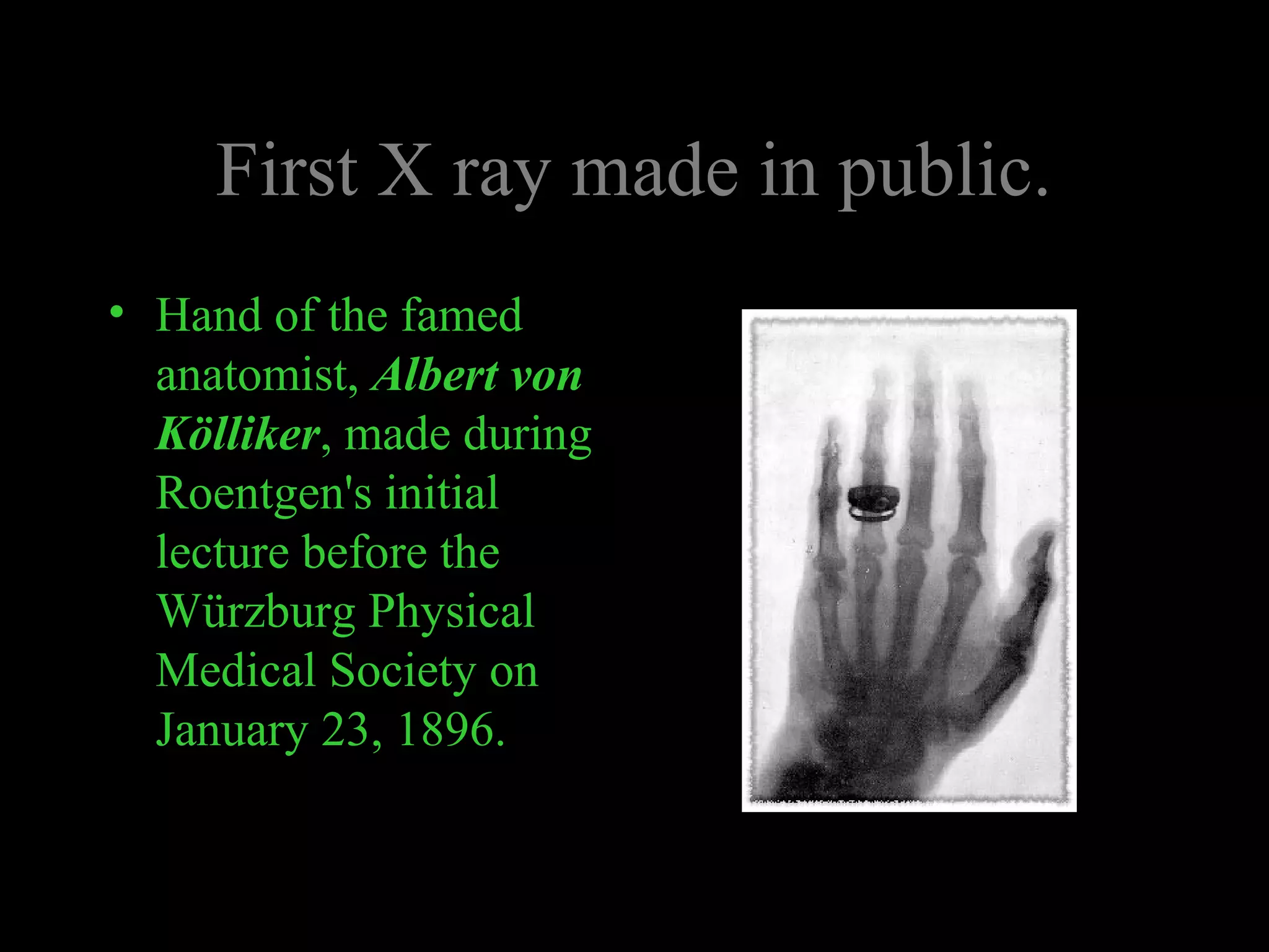 First X ray made in public. 
• Hand of the famed 
anatomist, Albert von 
Kölliker, made during 
Roentgen's initial 
lecture before the 
Würzburg Physical 
Medical Society on 
January 23, 1896. 
 