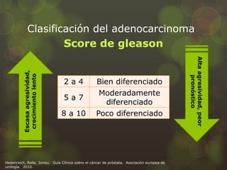 Clasificación del adenocarcinoma 
Score de gleason 
2 a 4 Bien diferenciado 
5 a 7 
Moderadamente 
diferenciado 
8 a 10 Poco diferenciado 
Escasa agresividad, 
crecimiento lento 
Alta agresividad, peor 
pronóstico 
Hedenreich, Bolla, Jonisu. Guía Clínica sobre el cáncer de próstata. Asociación europea de 
urología. 2010. 
 