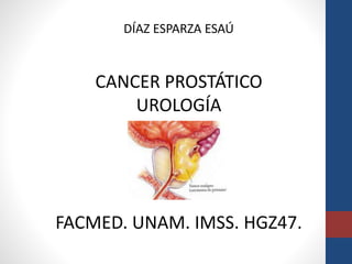 DÍAZ ESPARZA ESAÚ
CANCER PROSTÁTICO
UROLOGÍA
FACMED. UNAM. IMSS. HGZ47.
 