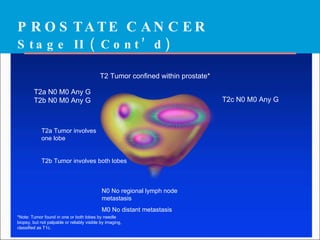 Ca prostate