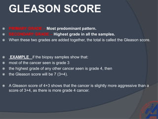 GLEASON SCORE
 PRIMARY GRADE – Most predominant pattern.
 SECONDARY GRADE – Highest grade in all the samples.
 When these two grades are added together, the total is called the Gleason score.
 EXAMPLE if the biopsy samples show that:
 most of the cancer seen is grade 3
 the highest grade of any other cancer seen is grade 4, then
 the Gleason score will be 7 (3+4).
 A Gleason score of 4+3 shows that the cancer is slightly more aggressive than a
score of 3+4, as there is more grade 4 cancer.
 