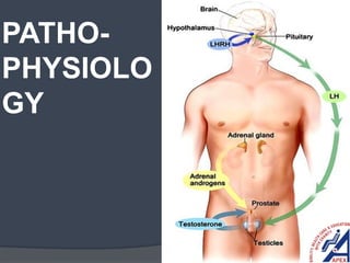 PATHO-
PHYSIOLO
GY
 