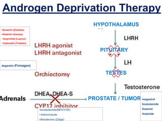 Androgen Deprivation Therapy
degarelix (Firmagon)
•enzalutamide(MDV3100)
• ketoconazole
•Abiraterone (Zytiga)
•Goserlin (Zoladex)
•Histerlin (Vantas)
• leuprolide (Lupron)
• triptorelin (Trelstar).
HYPOTHALAMUS
PITUITARY
TESTES
S
PROSTATE / TUMOR megestrol
bicalutamide
flutamid
ilutamide
 