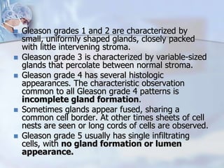  Gleason grades 1 and 2 are characterized by
small, uniformly shaped glands, closely packed
with little intervening stroma.
 Gleason grade 3 is characterized by variable-sized
glands that percolate between normal stroma.
 Gleason grade 4 has several histologic
appearances. The characteristic observation
common to all Gleason grade 4 patterns is
incomplete gland formation.
 Sometimes glands appear fused, sharing a
common cell border. At other times sheets of cell
nests are seen or long cords of cells are observed.
 Gleason grade 5 usually has single infiltrating
cells, with no gland formation or lumen
appearance.
 
