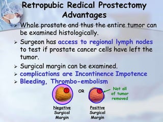 Retropubic Redical Prostectomy
Advantages
 Whole prostate and thus the entire tumor can
be examined histologically.
 Surgeon has access to regional lymph nodes
to test if prostate cancer cells have left the
tumor.
 Surgical margin can be examined.
 complications are Incontinence Impotence
 Bleeding, Thrombo-embolism
TT
Negative
Surgical
Margin
Positive
Surgical
Margin
Not all
of tumor
removed
OR
 