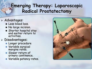Emerging Therapy: Laparoscopic
Radical Prostatectomy
 Advantages:
 Less blood loss.
 No large incision.
 Shorter hospital stay
and earlier return to
activities.
 Disadvantages:
 Longer procedure
 Variable surgical
margins rates.
 Slower return of
urinary continence.
 Variable potency rates.
 