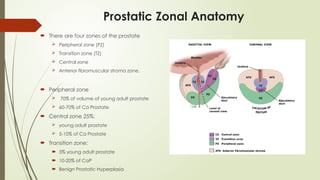 ca prostate-anatomy to diagnostic work up | PPTX