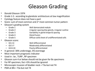 Gleason Grading
•   Donald Gleason 1974
•   Grade 1-5 : according to glandular architecture at low magnification
•   Cytology feature does not have a part
•   Score: sum of most common and 2nd most common tumor pattern
•   Gleason’s grading system
     –   Grade 1             Well demarcated nodule
     –   Grade 2             irregular spacing btw glands, irregular outline
     –   Grade 3             Variability in gland shape & spacing
     –   Grade 4             Gland fusion
     –   Grade 5             Diffuse solid sheet of undifferentiated cells
•   Gleason score:
     – GS 2-4                Well differentiated
     – GS 5-7                Moderately differentiated
     – GS 8-10               Poorly differentiated
•   In general: 30% understage, 5% overstage
•   Most important prognostic indicator
•   Used in : bx , TURP , RP specimen
•   Gleason sum 4 or below should not be given for Bx specimens
•   For RP specimen, foci <5% should be ignored
•   Microscopic invasion of bladder neck = T3a but not T4
•   PSM at BN = T3a but not T4
 