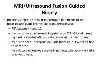 MRI/Ultrasound Fusion Guided
Biopsy
• precisely target the area of the prostate that needs to be
biopsied and guide the needle to the precise spot.
– PSA between 4 and 10.
– men who have had several biopsies with PSA >15 and have a
high risk for metastatic prostate cancer in the near future.
– men who have undergone multiple biopsies, but we can’t find
their cancer.
– help detect aggressive cancers in patients who have not had a
previous biopsy.
 