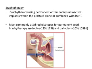 Brachytherapy
• Brachytherapy using permanent or temporary radioactive
implants within the prostate alone or combined with IMRT.
• Most commonly used radioisotopes for permanent seed
brachytherapy are iodine-125 (125I) and palladium-103 (103Pd)
 