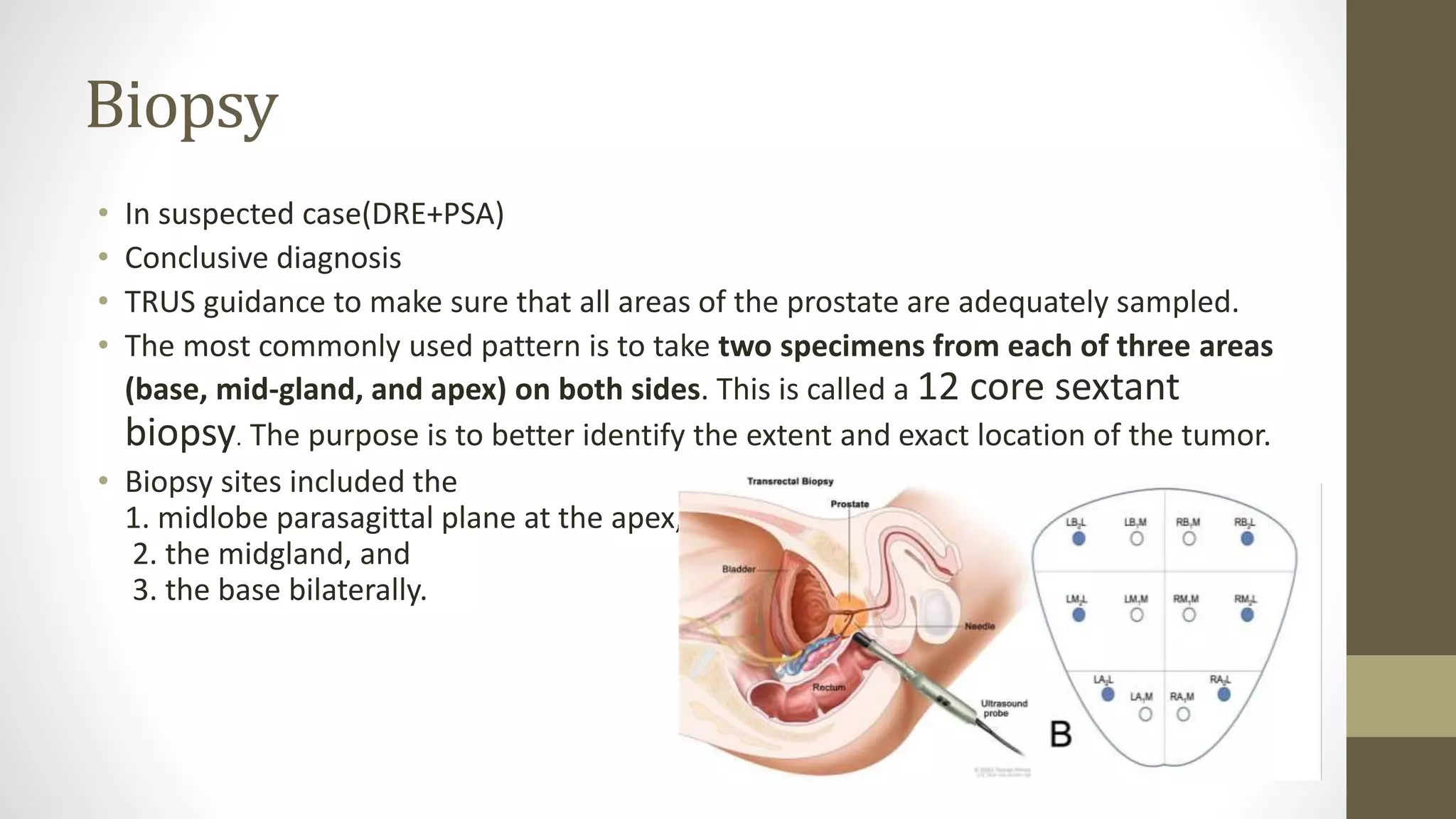 Carcinoma Of Prostate and its management | PPTX