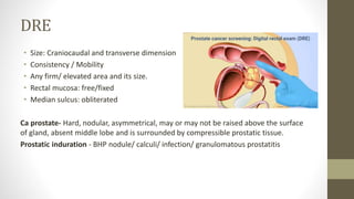 Carcinoma Of Prostate and its management | PPTX