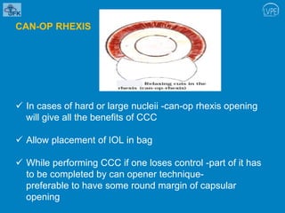 Capsular opening.pptx