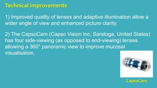 Capsule endoscopy | PPTX