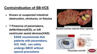 Intestinal Pacemaker Capsule endoscopy_ A new dimension of endoscopy Final.pptx