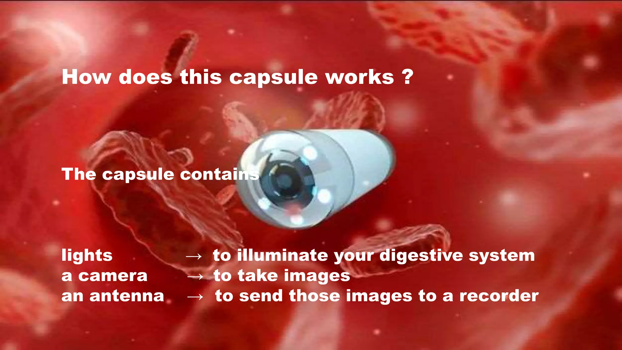 How does this capsule works ?
The capsule contains
lights → to illuminate your digestive system
a camera → to take images
an antenna → to send those images to a recorder
 