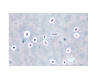 Capsule staining.pptx
