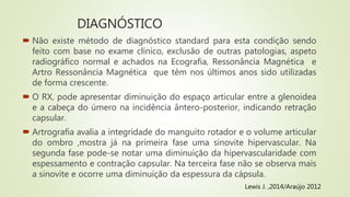 DIAGNÓSTICO
 Não existe método de diagnóstico standard para esta condição sendo
feito com base no exame clínico, exclusão de outras patologias, aspeto
radiográfico normal e achados na Ecografia, Ressonância Magnética e
Artro Ressonância Magnética que têm nos últimos anos sido utilizadas
de forma crescente.
 O RX, pode apresentar diminuição do espaço articular entre a glenoidea
e a cabeça do úmero na incidência ântero-posterior, indicando retração
capsular.
 Artrografia avalia a integridade do manguito rotador e o volume articular
do ombro ,mostra já na primeira fase uma sinovite hipervascular. Na
segunda fase pode-se notar uma diminuição da hipervascularidade com
espessamento e contração capsular. Na terceira fase não se observa mais
a sinovite e ocorre uma diminuição da espessura da cápsula.
Lewis J. ,2014/Araújo 2012
 