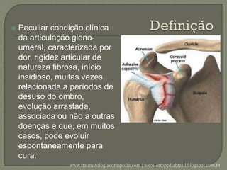  Peculiar condição clínica
da articulação gleno-
umeral, caracterizada por
dor, rigidez articular de
natureza fibrosa, início
insidioso, muitas vezes
relacionada a períodos de
desuso do ombro,
evolução arrastada,
associada ou não a outras
doenças e que, em muitos
casos, pode evoluir
espontaneamente para
cura.
www.traumatologiaeortopedia.com | www.ortopediabrasil.blogspot.com.br
 