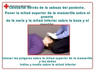 Colocarse detrás de la cabeza del paciente.  Poner la mitad superior de la mascarilla sobre el puente  de la nariz y la mitad inferior sobre la boca y el mentón. Colocar los pulgares sobre la mitad superior de la mascarilla  y los dedos índice y medio sobre la mitad inferior 