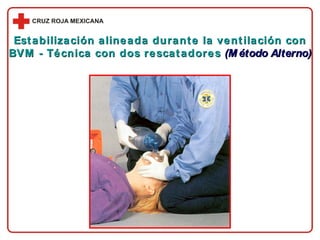 Estabilización alineada durante la ventilación con BVM - Técnica con dos rescatadores  (Método Alterno) 