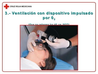 3.- Ventilación con dispositivo impulsado por 0 2 (Que no rebasen los 40 cm./H2O) 