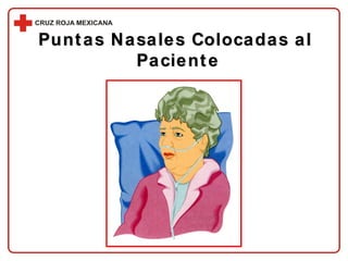 Puntas Nasales Colocadas al  Paciente 