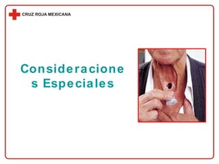 Consideraciones Especiales 