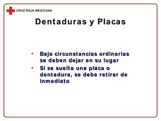 Dentaduras y Placas Bajo circunstancias ordinarias se deben dejar en su lugar Si se suelta una placa o dentadura, se debe retirar de inmediato 