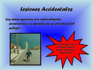Lesiones AccidentalesLesiones Accidentales
Los niños menores son naturalmenteLos niños menores son naturalmente
aventureros y a menudo no se percatan delaventureros y a menudo no se percatan del
peligropeligro
Los accidentes son laLos accidentes son la
principal causa deprincipal causa de
muerte en la niñez ymuerte en la niñez y
adolescenciaadolescencia
 