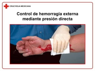 Control de hemorragia externa mediante presión directa 