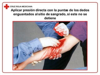 Aplicar presión directa con la puntas de los dedos enguantados al sitio de sangrado, si este no se detiene 