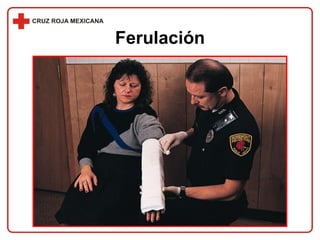 Ferulación 