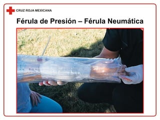 Férula de Presión – Férula Neumática 