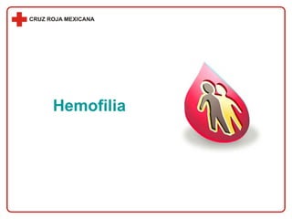 Hemofilia 