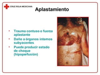 Trauma contuso o fuerza aplastante Daño a órganos internos subyacentes Puede producir estado de choque (hipoperfusión) Aplastamiento 