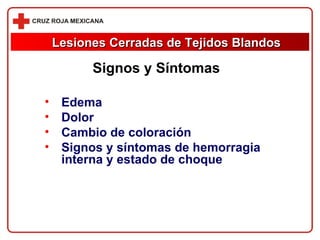 Edema Dolor Cambio de coloración Signos y síntomas de hemorragia interna y estado de choque Lesiones Cerradas de Tejidos Blandos Signos y Síntomas 