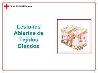 Lesiones Abiertas de Tejidos Blandos 