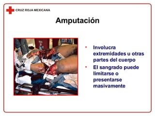 Involucra extremidades u otras partes del cuerpo El sangrado puede limitarse o presentarse masivamente Amputación 